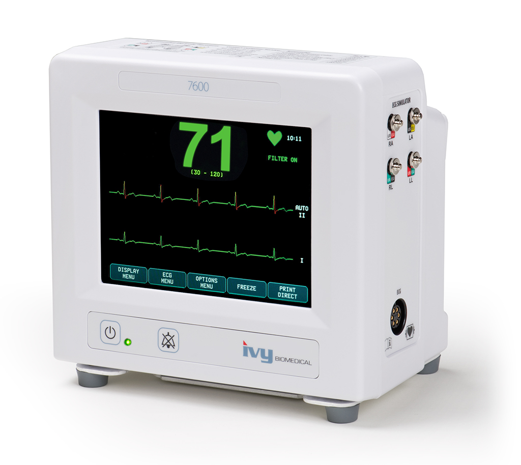 Cardiac Trigger Monitor